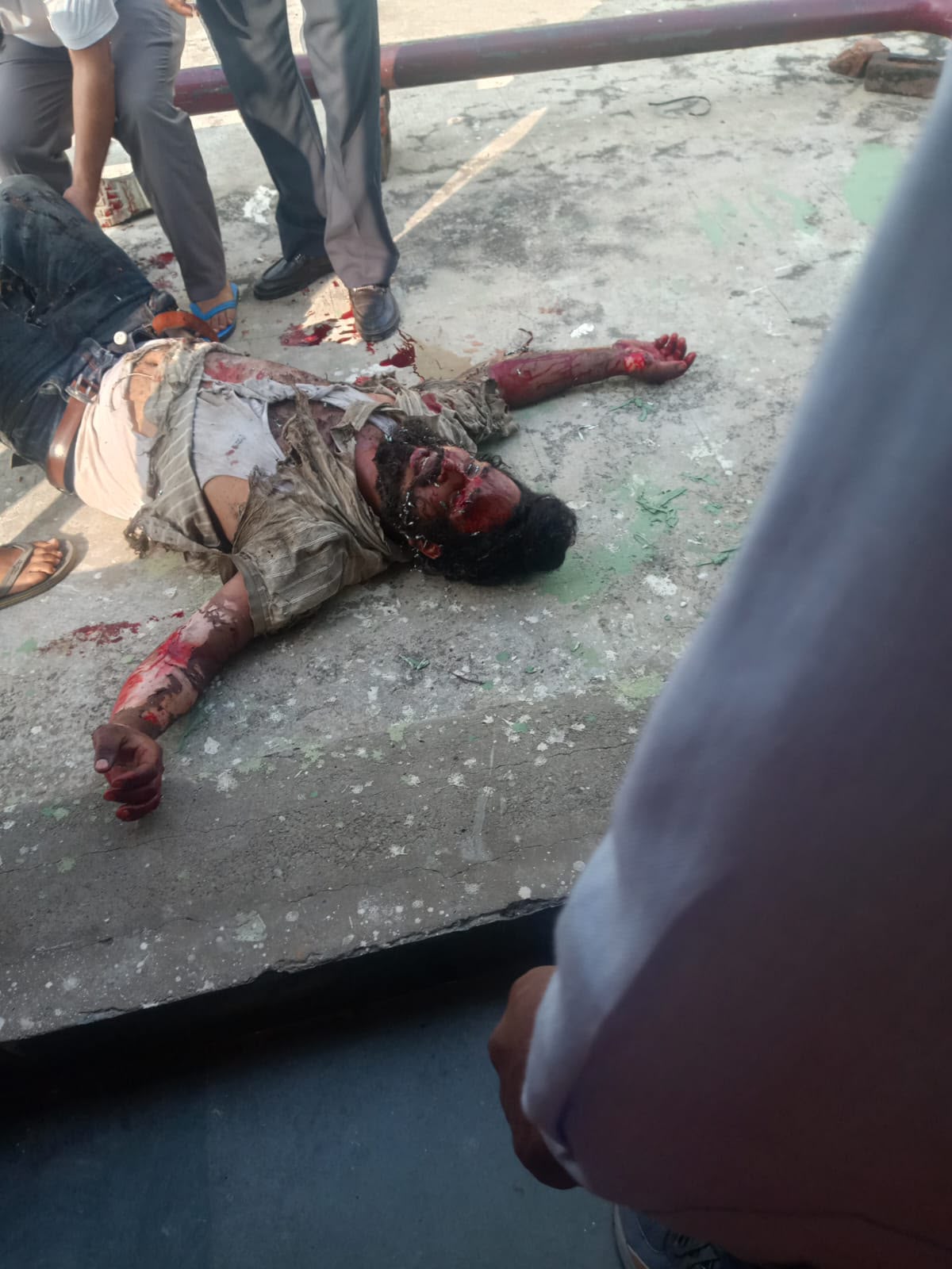 Chandigarh: एसी ब्लास्ट से दहला सेक्टर-26, इंस्टीट्यूट में धमाके के बाद तीन लोग गंभीर घायल
